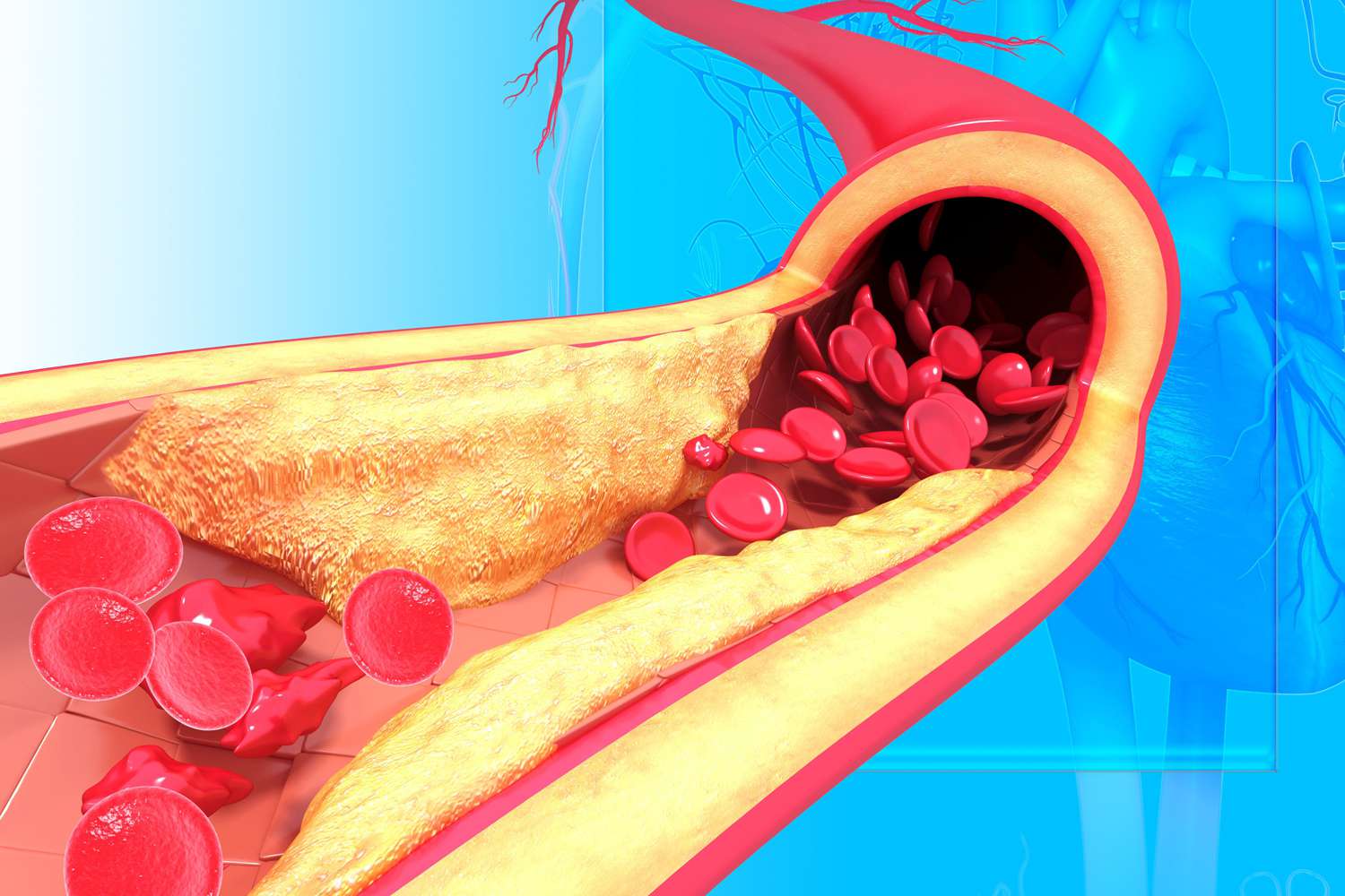 cholesterol