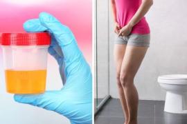 Urine Infection