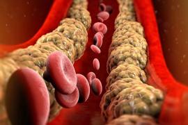 Cholesterol