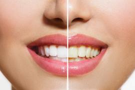 Teeth