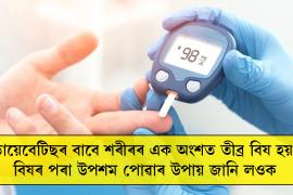 ডায়েবেটিছ এনেকুৱা এটা ৰোগ যিটো আন বহু সমস্যাৰ মূল বুলি গণ্য কৰা হয়